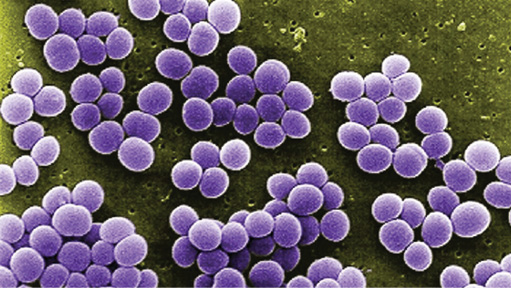 Staphylococcus_aureus_electron_microscopy